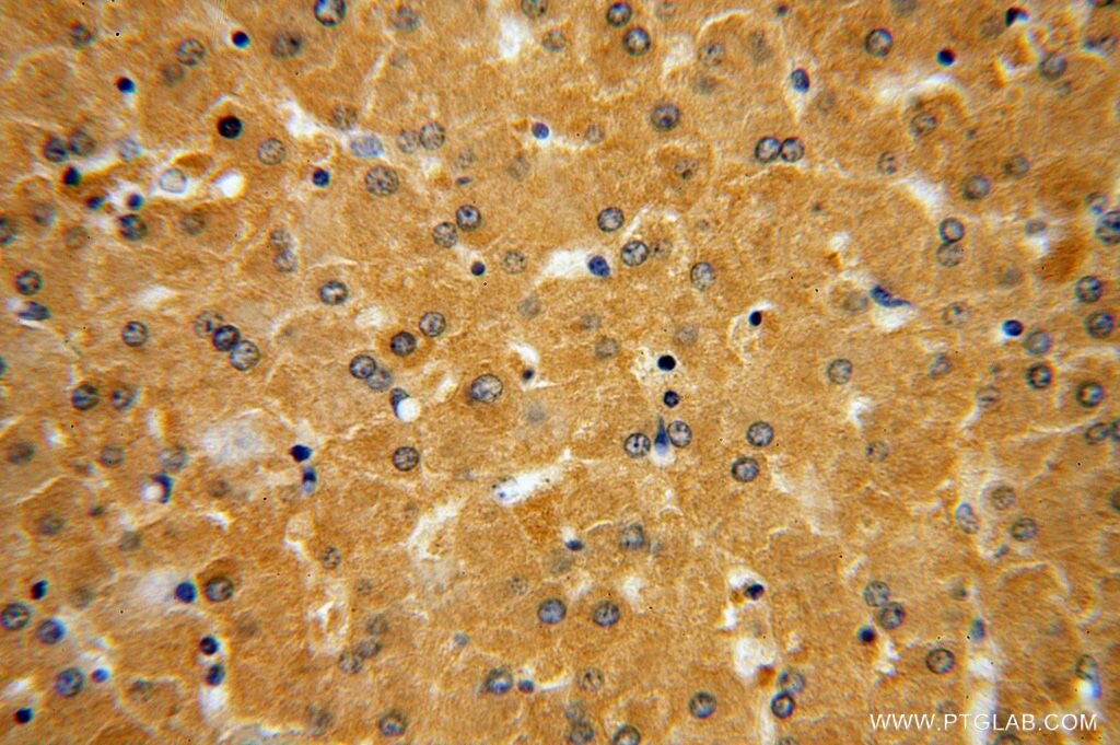 RNH1 IHC Immunohistochemical 10345-1-AP RNH1 Antibody MGC18200; MGC4569; MGC54054; RAI; RNH