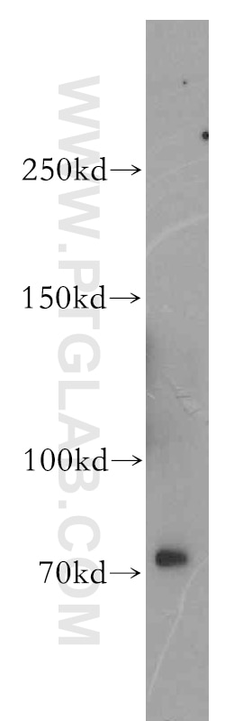 mouse stomach tissue were subjected to SDS PAGE followed by western blot with 11982-1-AP(ROBO3 Antibody) at dilution of 1:600 ROBO3 western blot WB 11982-1-AP ROBO3 Antibody FLJ21044; HGPPS; HGPS; RBIG1; RIG1
