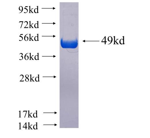 RP11-529I10.4 fusion protein ag15029 SDS-PAGE
