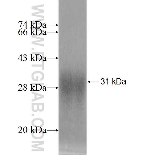 RPL10L fusion protein ag9575 SDS-PAGE