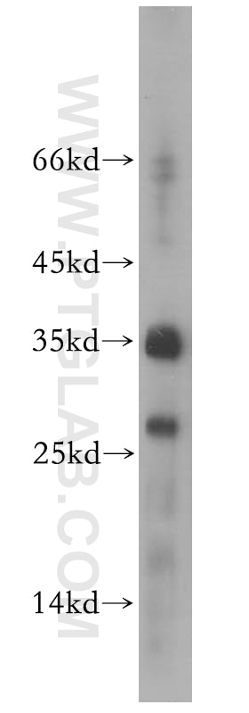 RPL13A western blot WB 14633-1-AP RPL13A Antibody 