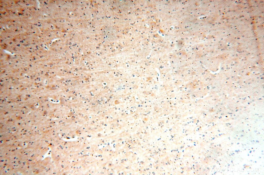 RPL19 IHC Immunohistochemical 14701-1-AP RPL19 Antibody DKFZp779D216; FLJ27452; MGC71997