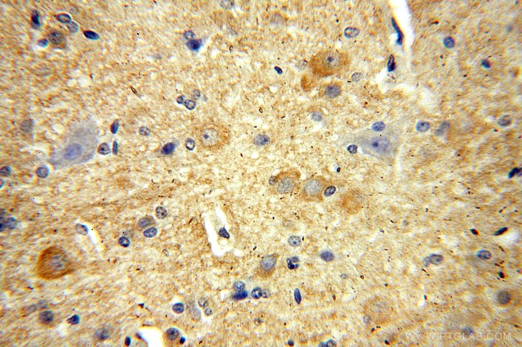 RPL19 IHC Immunohistochemical 14701-1-AP RPL19 Antibody DKFZp779D216; FLJ27452; MGC71997