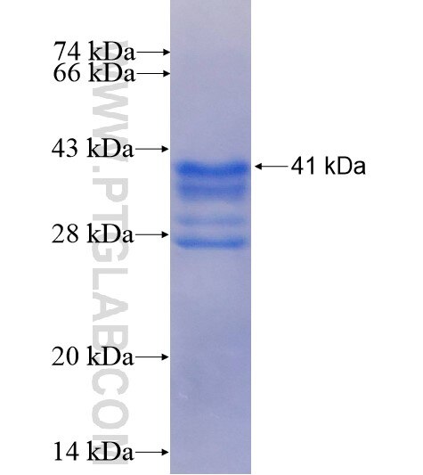 RPL35 fusion protein ag6615 SDS-PAGE