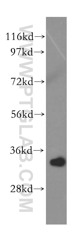 HepG2 cells were subjected to SDS PAGE followed by western blot with 15430-1-AP(RPL5 Antibody) at dilution of 1:800 RPL5 western blot WB 15430-1-AP RPL5 Antibody DBA6; MGC117339; MSTP030