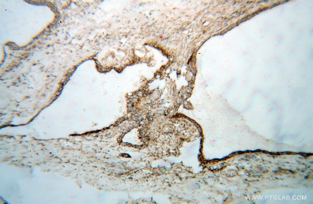 RRM1 IHC Immunohistochemical 10526-1-AP RRM1 Antibody RRM1;R1;RIR1;RR1 ;
