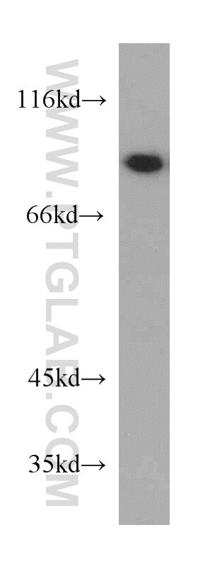 RRM1 western blot WB 10526-1-AP RRM1 Antibody RRM1;R1;RIR1;RR1 ;
