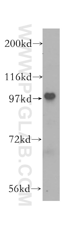 HeLa cells were subjected to SDS PAGE followed by western blot with 12170-1-AP(RTF1 Antibody) at dilution of 1:800 RTF1 western blot WB 12170-1-AP RTF1 Antibody CDG1N; GTL7; KIAA0252