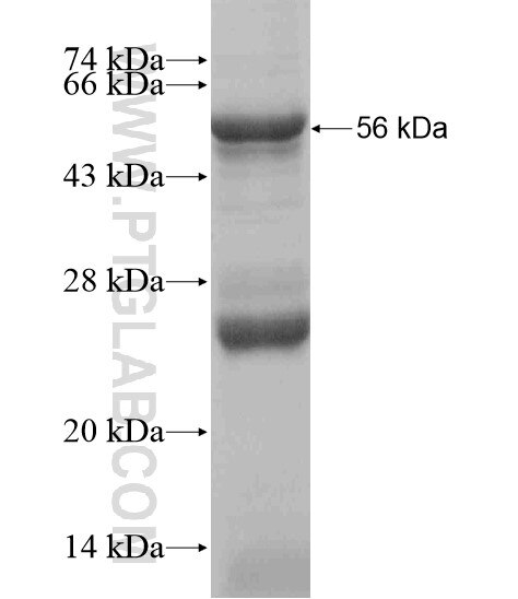RTP3 fusion protein ag18958 SDS-PAGE