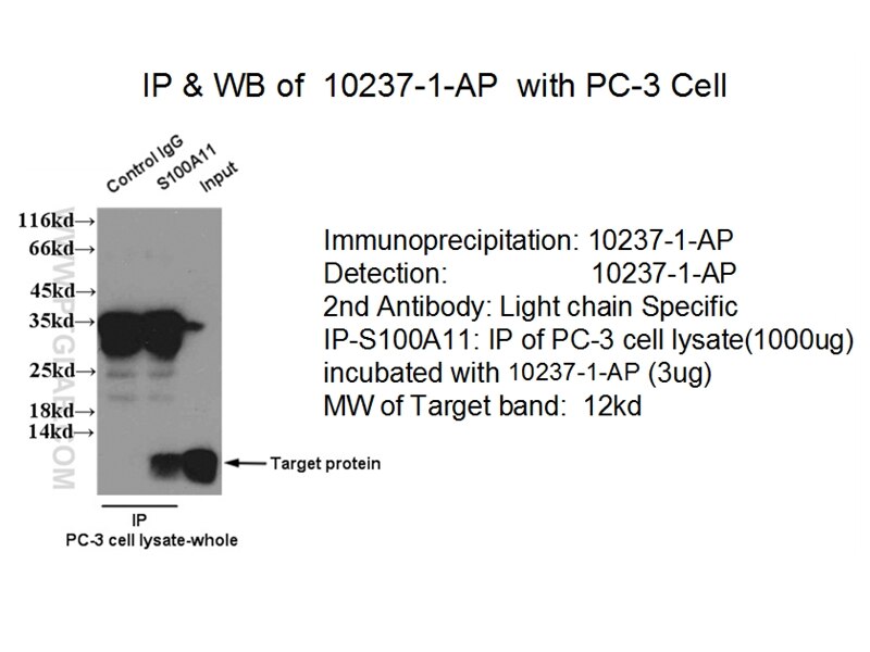 S100A11 IP 10237-1-AP S100A11 Antibody MLN70; S100C