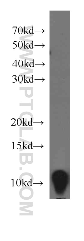 A431 cells were subjected to SDS PAGE followed by western blot with 60024-1-Ig(S100A11 Antibody) at dilution of 1:1000 S100A11 western blot WB 60024-1-Ig S100A11 Antibody MLN70; S100C
