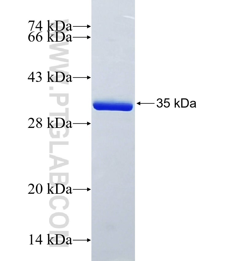 S100A14 fusion protein ag0757 SDS-PAGE