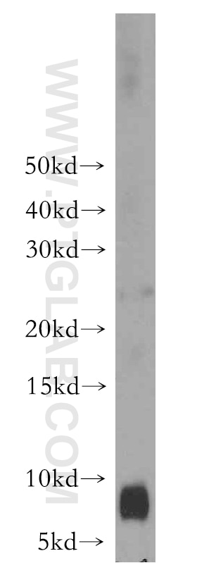 S100A8 western blot WB 15792-1-AP S100A8 Antibody 60B8AG; CAGA; CFAG; CGLA; CP-10; L1Ag; MA387; MIF; MRP8; NIF; P8