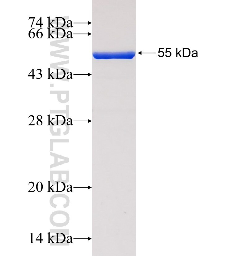 SAE1 fusion protein ag0275 SDS-PAGE