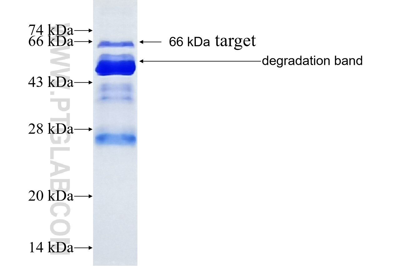 SAMD4A fusion protein ag11273 SDS-PAGE