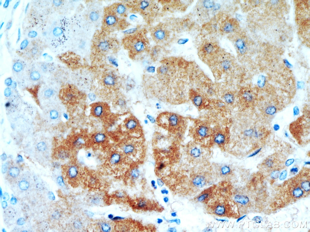 SAMM50 IHC Immunohistochemical 20824-1-AP SAMM50 Antibody CGI-51; FLJ35825; FLJ42905; FLJ99036; OMP85; SAM50; TOB55; TRG-3; YNL026W