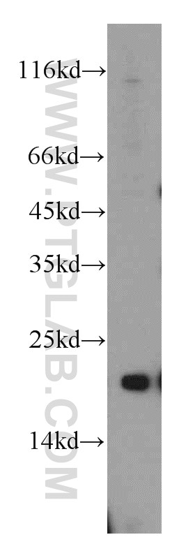 mouse liver tissue were subjected to SDS PAGE followed by western blot with 15350-1-AP(SAR1A Antibody) at dilution of 1:1000 SAR1A western blot WB 15350-1-AP SAR1A Antibody SAR1; SARA1; Sara; masra2