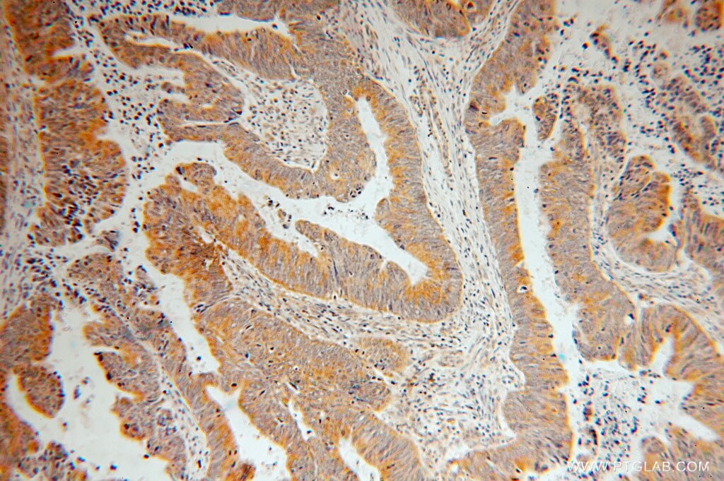 SAR1B IHC Immunohistochemical 15453-1-AP SAR1B Antibody ANDD; CMRD; GTBPB; SARA2