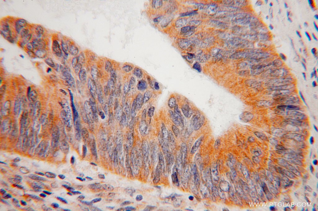 SAR1B IHC Immunohistochemical 15453-1-AP SAR1B Antibody ANDD; CMRD; GTBPB; SARA2