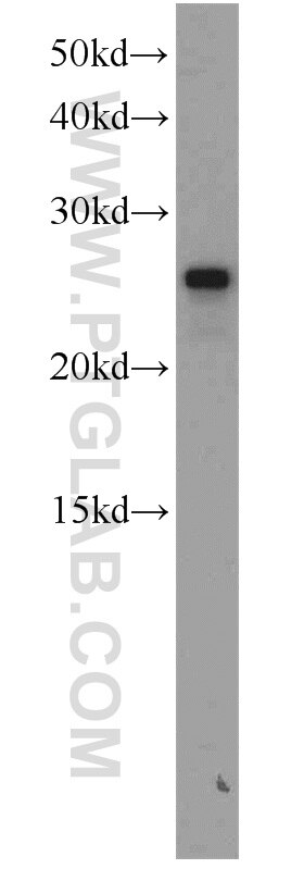 SAR1B western blot WB 15453-1-AP SAR1B Antibody ANDD; CMRD; GTBPB; SARA2