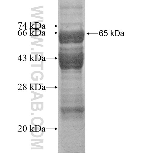 SASS6 fusion protein ag15917 SDS-PAGE