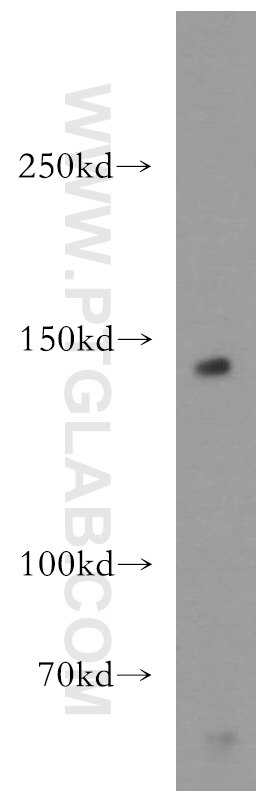 HEK-293 cells were subjected to SDS PAGE followed by western blot with 12266-1-AP(SCAP Antibody) at dilution of 1:300 SCAP western blot WB 12266-1-AP SCAP Antibody KIAA0199