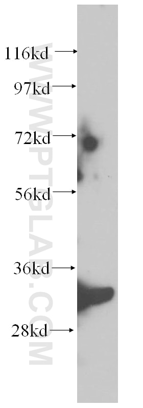 mouse liver tissue were subjected to SDS PAGE followed by western blot with 14919-1-AP(SCGN Antibody) at dilution of 1:600 SCGN western blot WB 14919-1-AP SCGN Antibody CALBL; DJ501N12.8; SECRET; SEGN; setagin