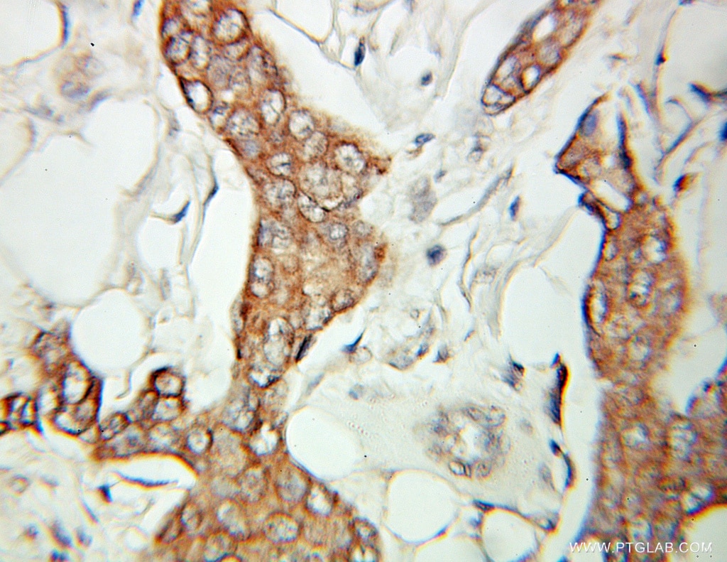 SCLY IHC Immunohistochemical 10667-1-AP SCLY Antibody SCL