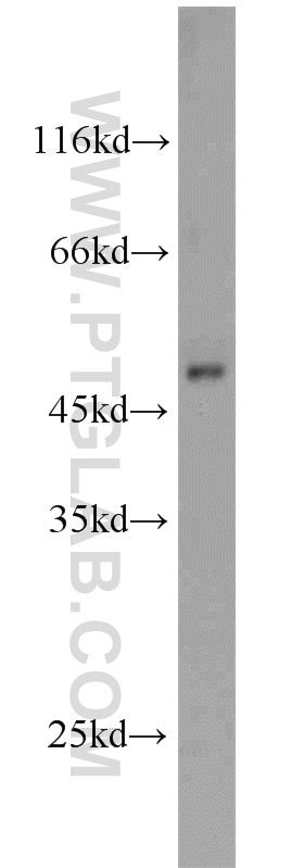 SCLY western blot WB 10667-1-AP SCLY Antibody SCL