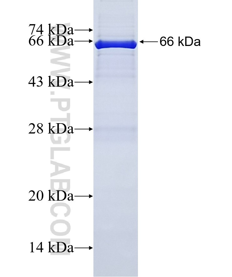 SCOT fusion protein ag2818 SDS-PAGE