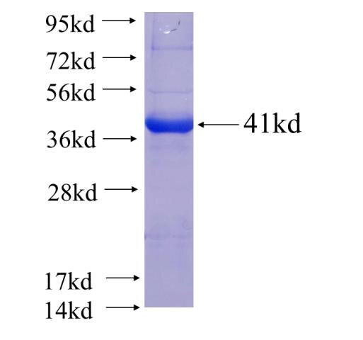 SCPX fusion protein ag6002 SDS-PAGE