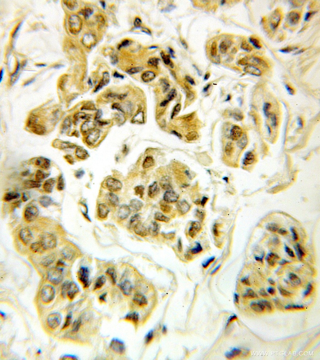 SDCBP2 IHC Immunohistochemical 10407-1-AP SDCBP2 Antibody FLJ12256; SITAC18; ST-2