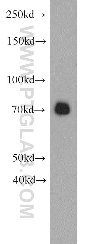 mouse heart tissue were subjected to SDS PAGE followed by western blot with 19242-1-AP(SEMA3C Antibody) at dilution of 1:1000 SEMA3C western blot WB 19242-1-AP SEMA3C Antibody SEMAE; SemE