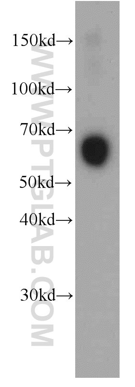 Human Blood were subjected to SDS PAGE followed by western blot with 66078-1-Ig(SERPINA3,AACT Antibody) at dilution of 1:1000 SERPINA3,AACT western blot WB 66078-1-Ig SERPINA3,AACT Antibody AACT; ACT; GIG24; GIG25; MGC88254