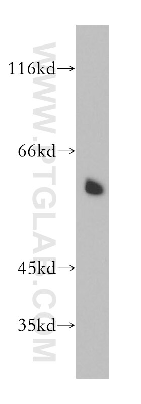 Corticosteroid binding globulin western blot WB 12010-1-AP Corticosteroid binding globulin Antibody CBG