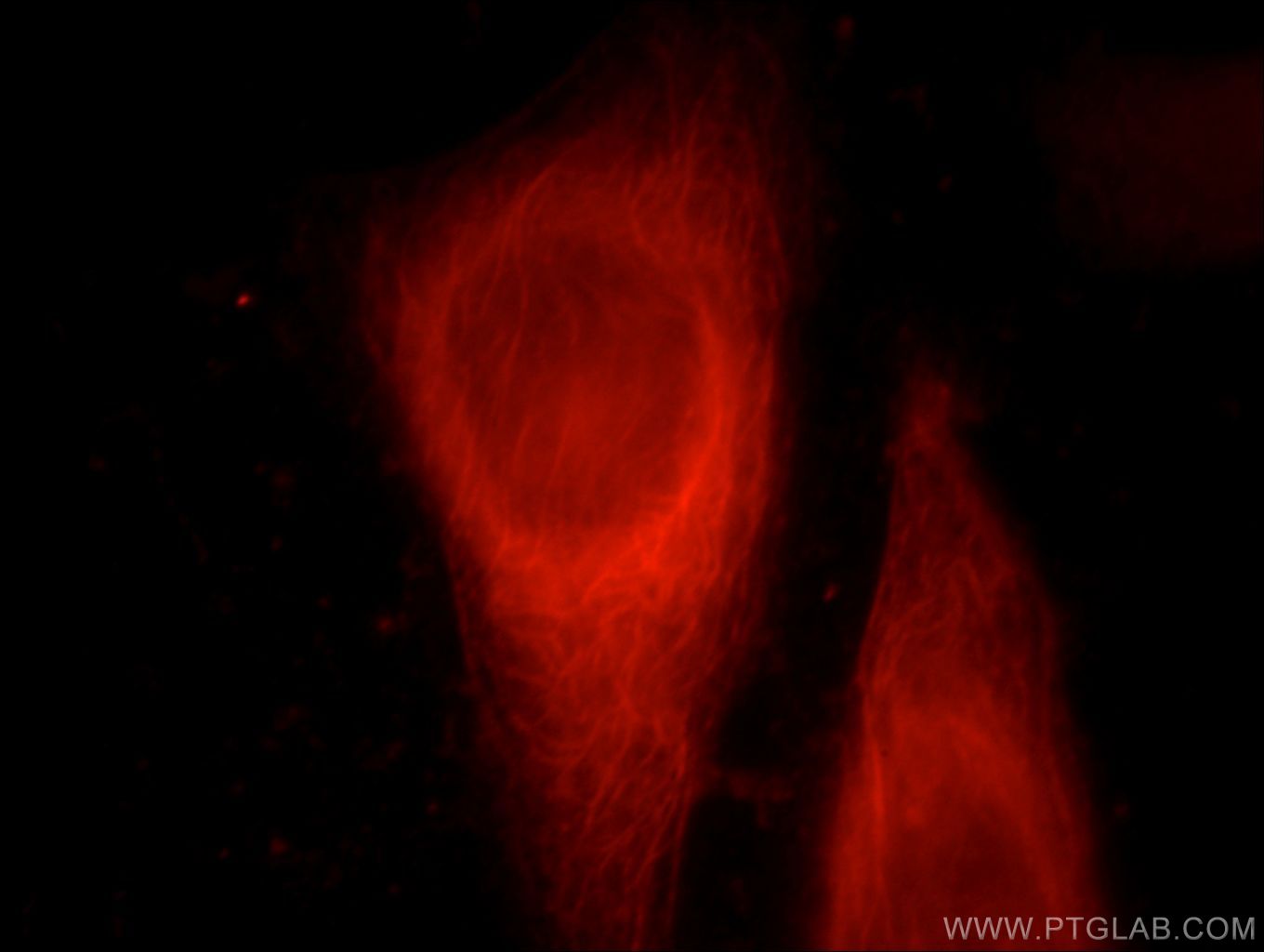 Immunofluorescent analysis of HepG2 cells, using SERPINB10 antibody 21719-1-AP at 1:25 dilution and Rhodamine-labeled goat anti-rabbit IgG (red). SERPINB10 Immunofluorescence IF 21719-1-AP SERPINB10 Antibody PI10; bomapin