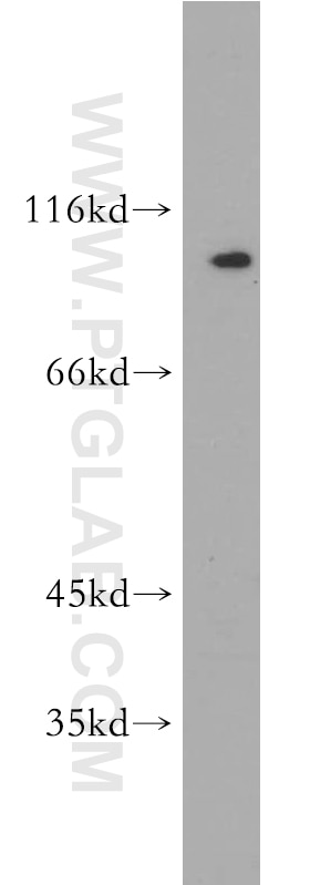 mouse spleen tissue were subjected to SDS PAGE followed by western blot with 21719-1-AP(SERPINB10 Antibody) at dilution of 1:1000 SERPINB10 western blot WB 21719-1-AP SERPINB10 Antibody PI10; bomapin