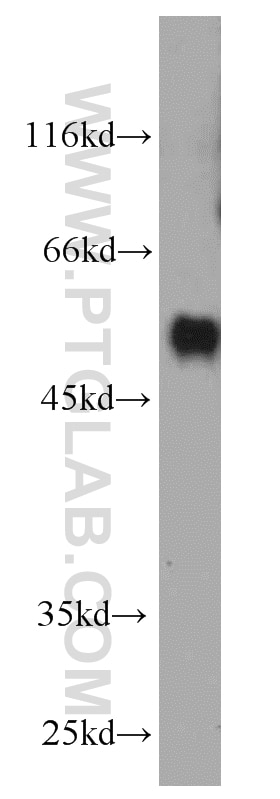 Human brain were subjected to SDS PAGE followed by western blot with 66052-1-Ig(SERPINC1 Antibody) at dilution of 1:500 SERPINC1 western blot WB 66052-1-Ig SERPINC1 Antibody AT3; ATIII; MGC22579