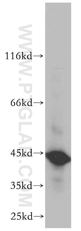 A549 cells were subjected to SDS PAGE followed by western blot with 11303-1-AP(SERPINE2 Antibody) at dilution of 1:600 SERPINE2 western blot WB 11303-1-AP SERPINE2 Antibody GDN; PI7; PN1; PNI