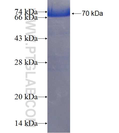 SETD7 fusion protein ag18219 SDS-PAGE