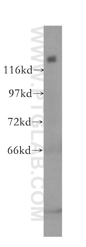SF3B2 western blot WB 10919-1-AP SF3B2 Antibody SAP145; SF3B145; SF3b1; SF3b150