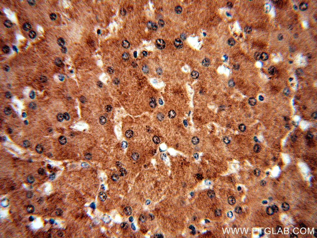 SGMS1 IHC Immunohistochemical 19050-1-AP SGMS1 Antibody MGC17342; MOB; MOB1; SMS1; TMEM23; hmob33