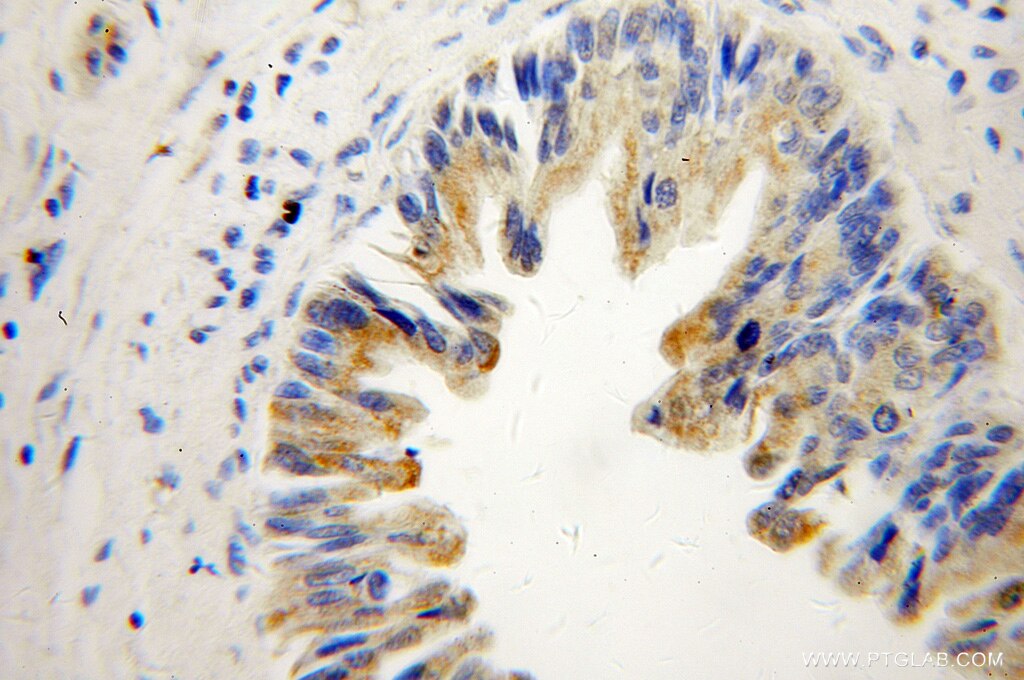 SHC3 IHC Immunohistochemical 12436-1-AP SHC3 Antibody N-Shc; NSHC; RAI; SHCC