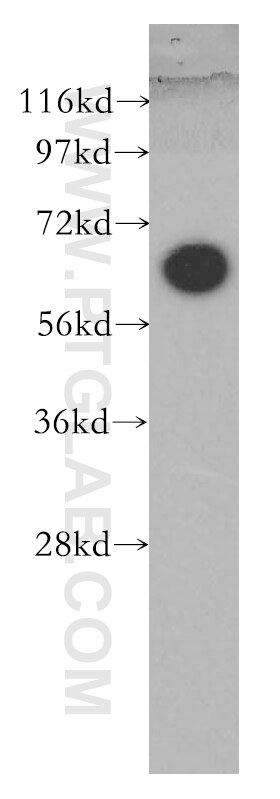 SHC3 western blot WB 12436-1-AP SHC3 Antibody N-Shc; NSHC; RAI; SHCC