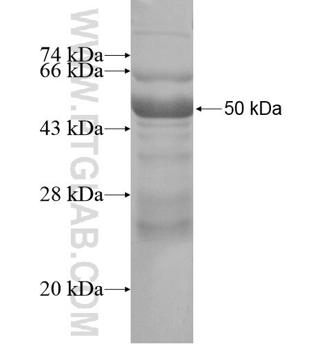 SIM2 fusion protein ag15204 SDS-PAGE
