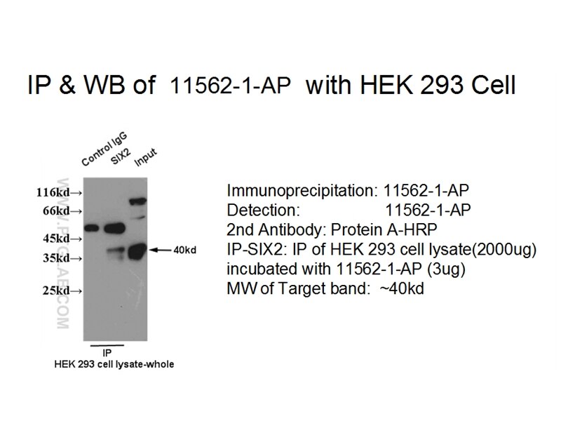 SIX2 IP 11562-1-AP SIX2 Antibody 