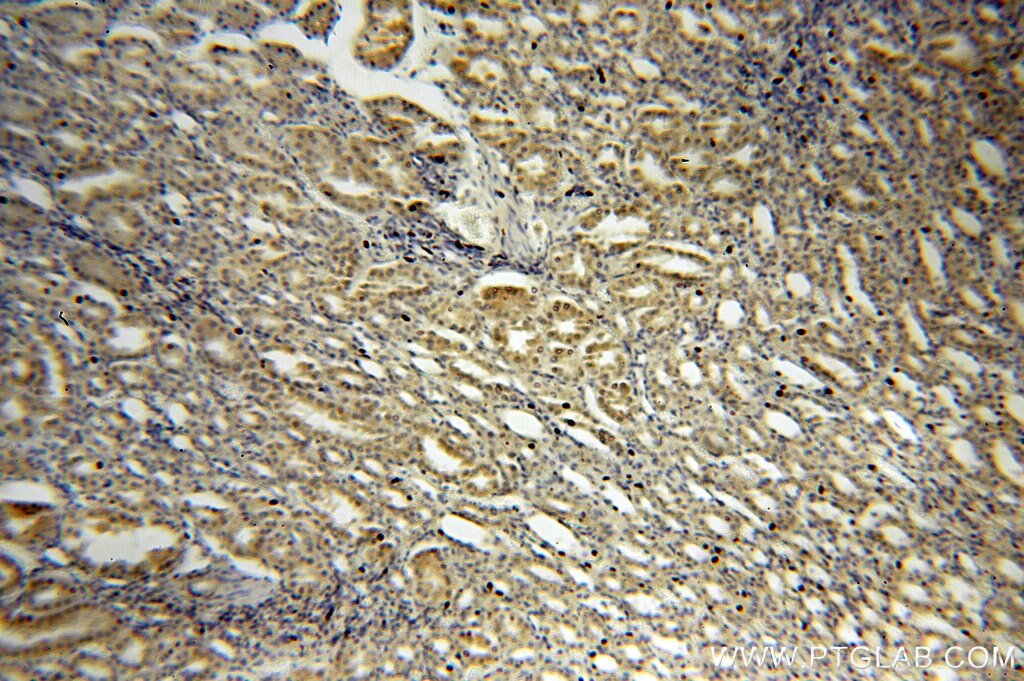 SIX2 IHC Immunohistochemical 11562-1-AP SIX2 Antibody 