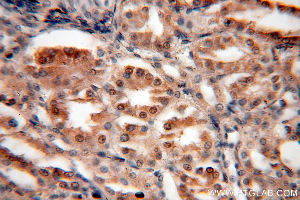 SIX2 IHC Immunohistochemical 11562-1-AP SIX2 Antibody 