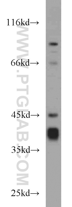 SIX2 western blot WB 11562-1-AP SIX2 Antibody 