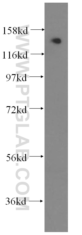 human kidney tissue were subjected to SDS PAGE followed by western blot with 11462-1-AP(SKIV2L Antibody) at dilution of 1:400 SKIV2L western blot WB 11462-1-AP SKIV2L Antibody 170A; DDX13; HLP; SKI2; SKI2W; SKIV2